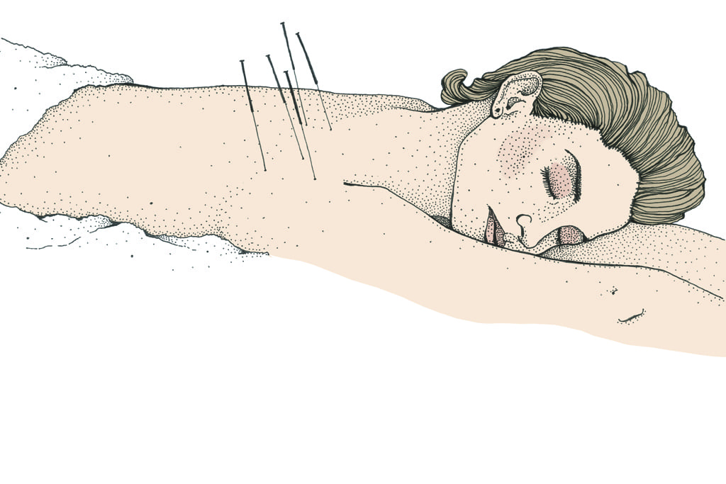 What's the deal with acupuncture?
